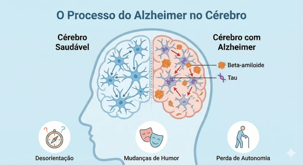 Comparação entre cérebro saudável e cérebro com Alzheimer